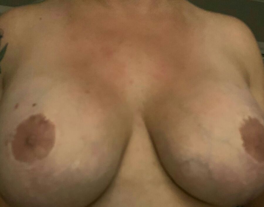 Tetas Venosas XL