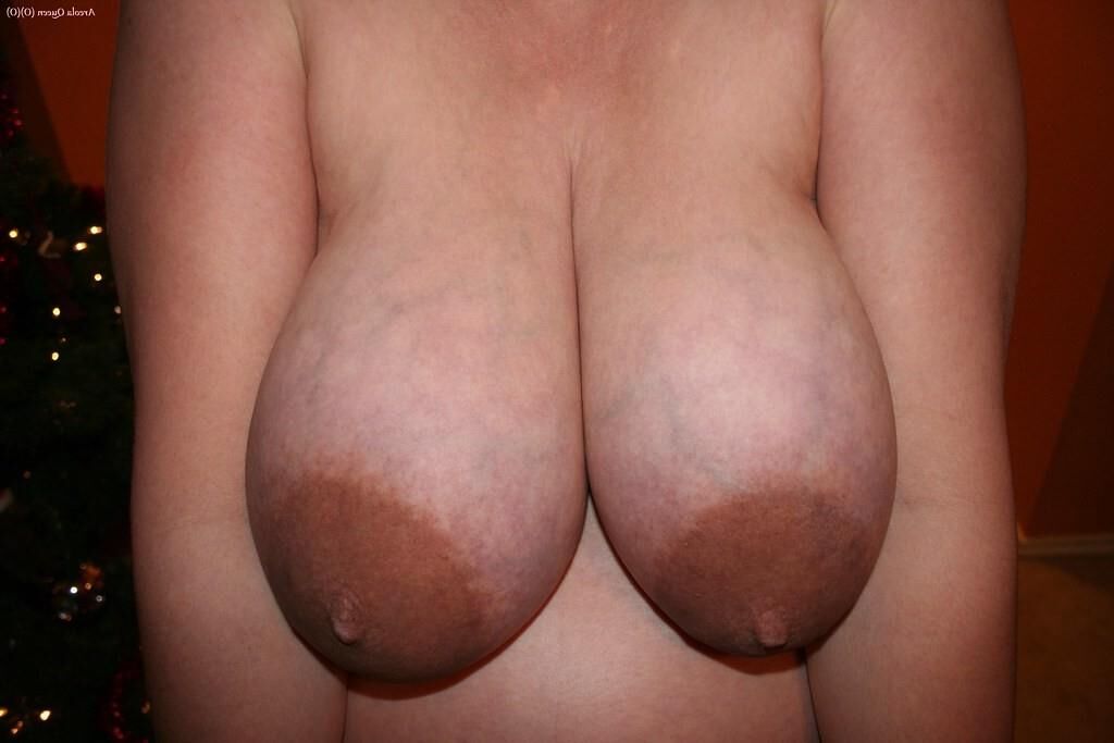 areola embarazada