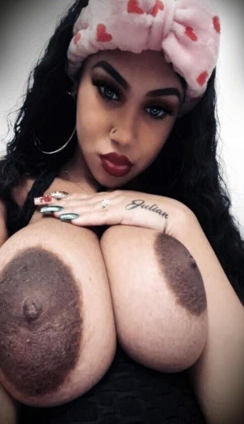 Areolas 