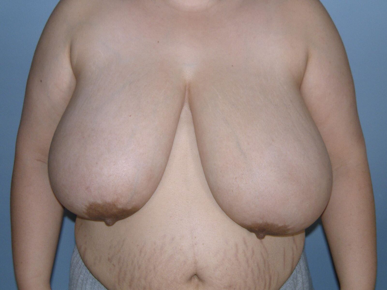 Las tetas tan caídas de sus pezones apuntan