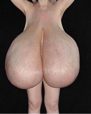 Extrem big Titts 