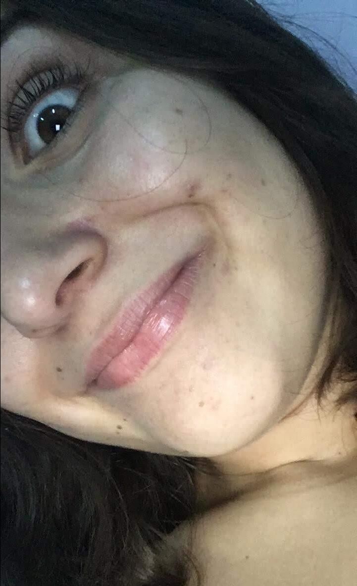 Enfermero