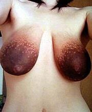 huge areolas
