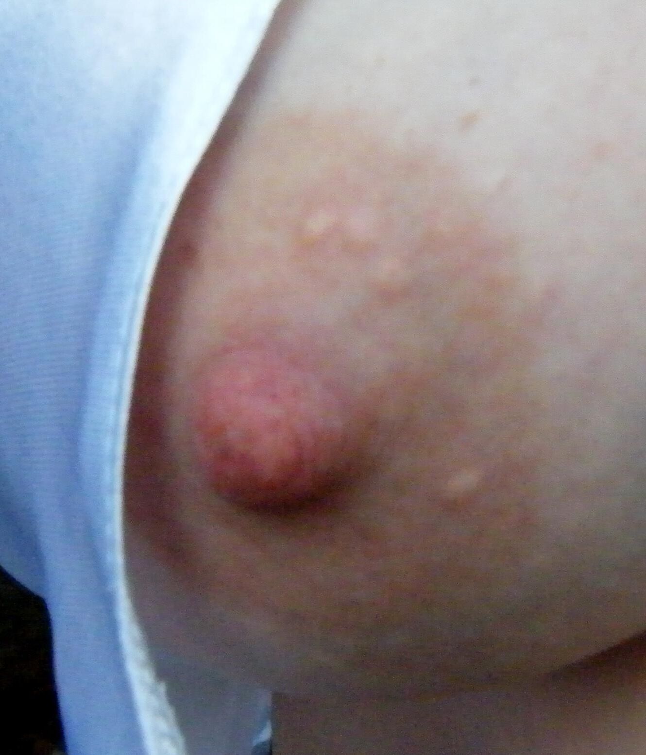 Nipples fr you