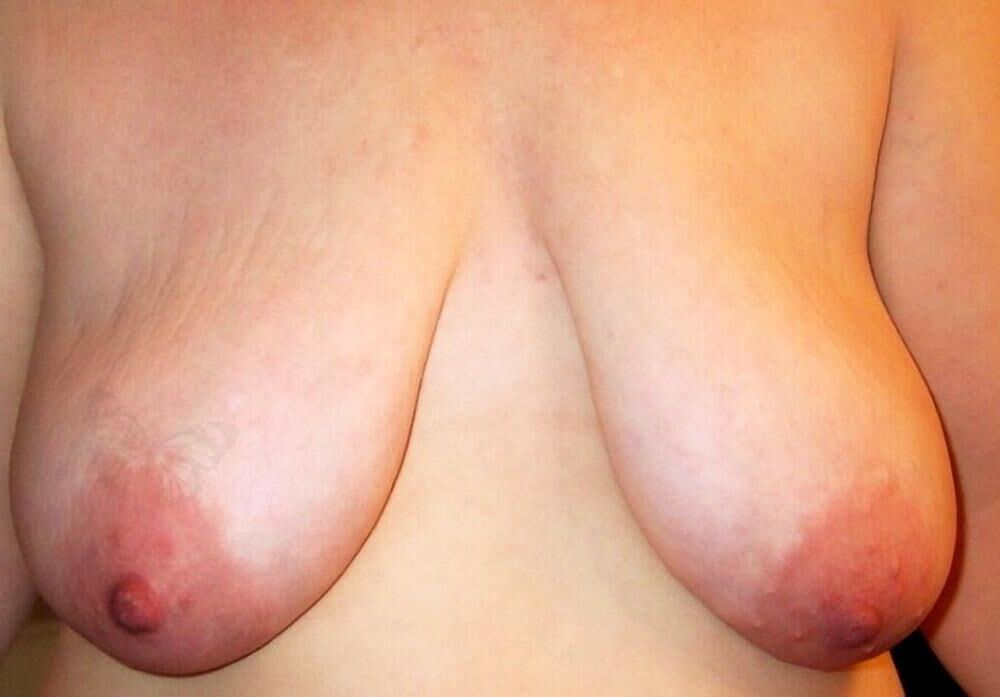 Spectacular saggy tits 
