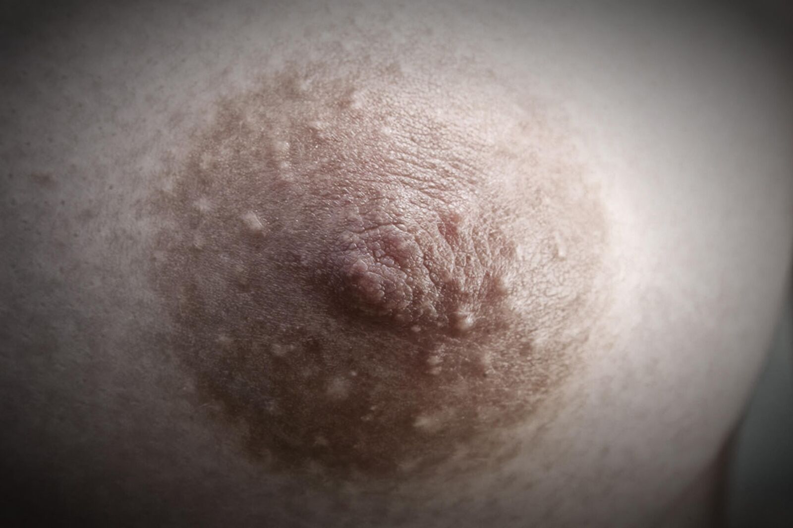 Nippel Nahaufahmen