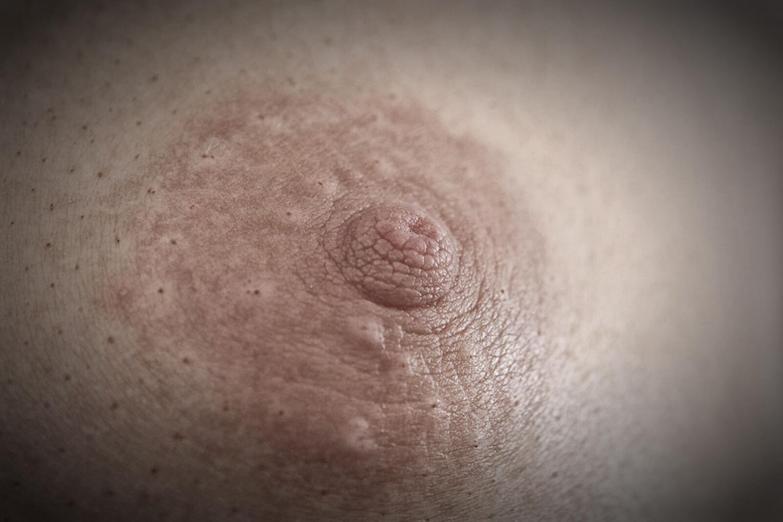 Nippel Nahaufahmen