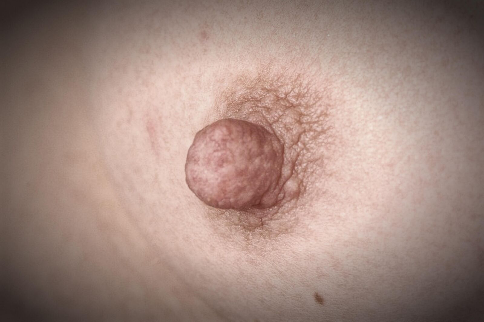Nippel Nahaufahmen