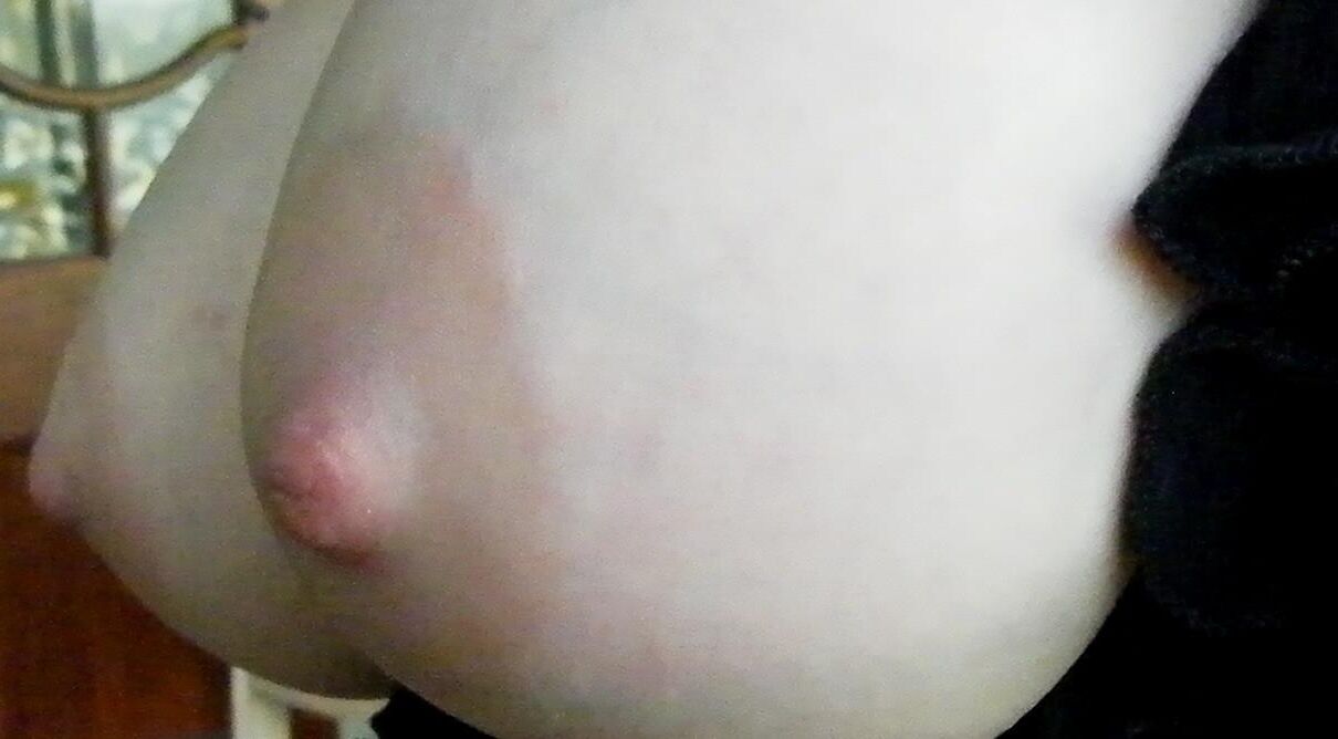 Nipppleland.