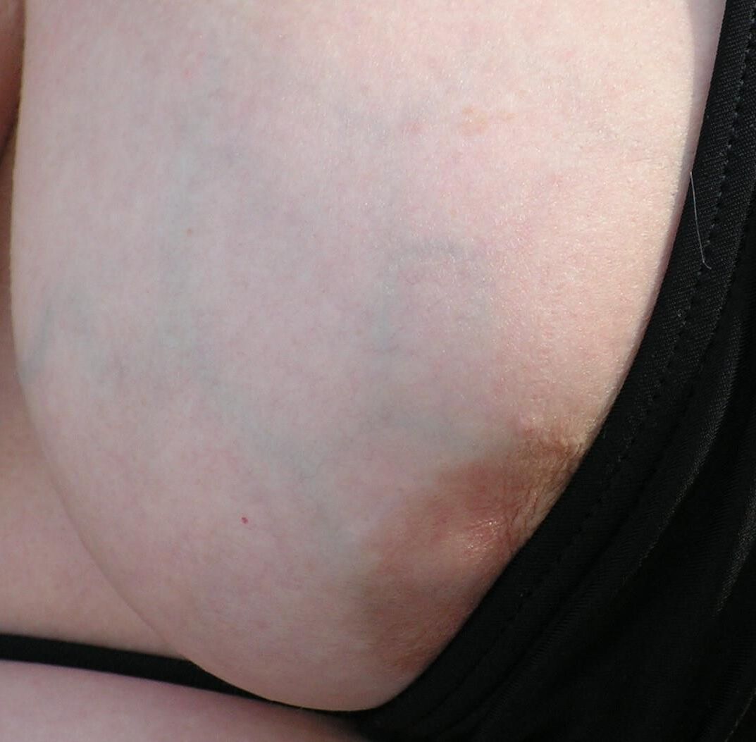 Nipppleland.