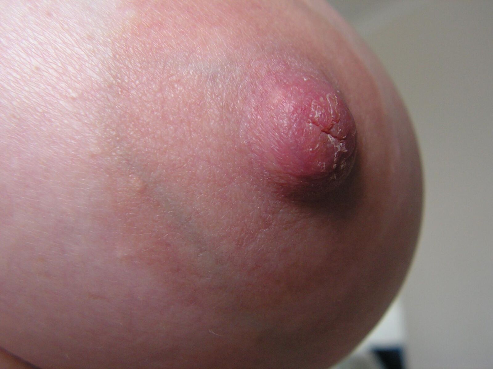 Nipppleland.