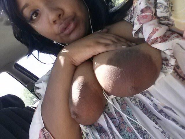 Areolas oscuras