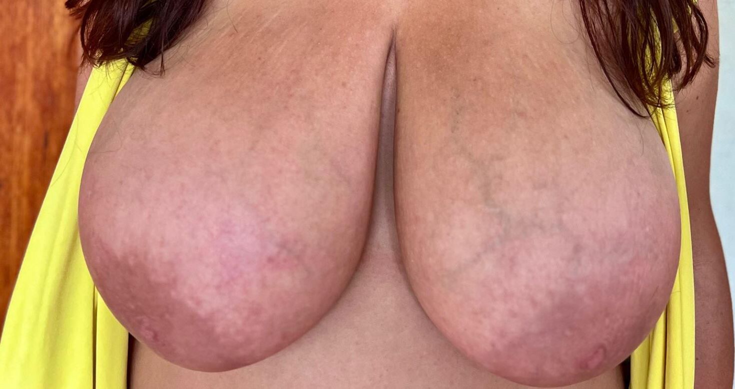 Mamelles de toutes sortes