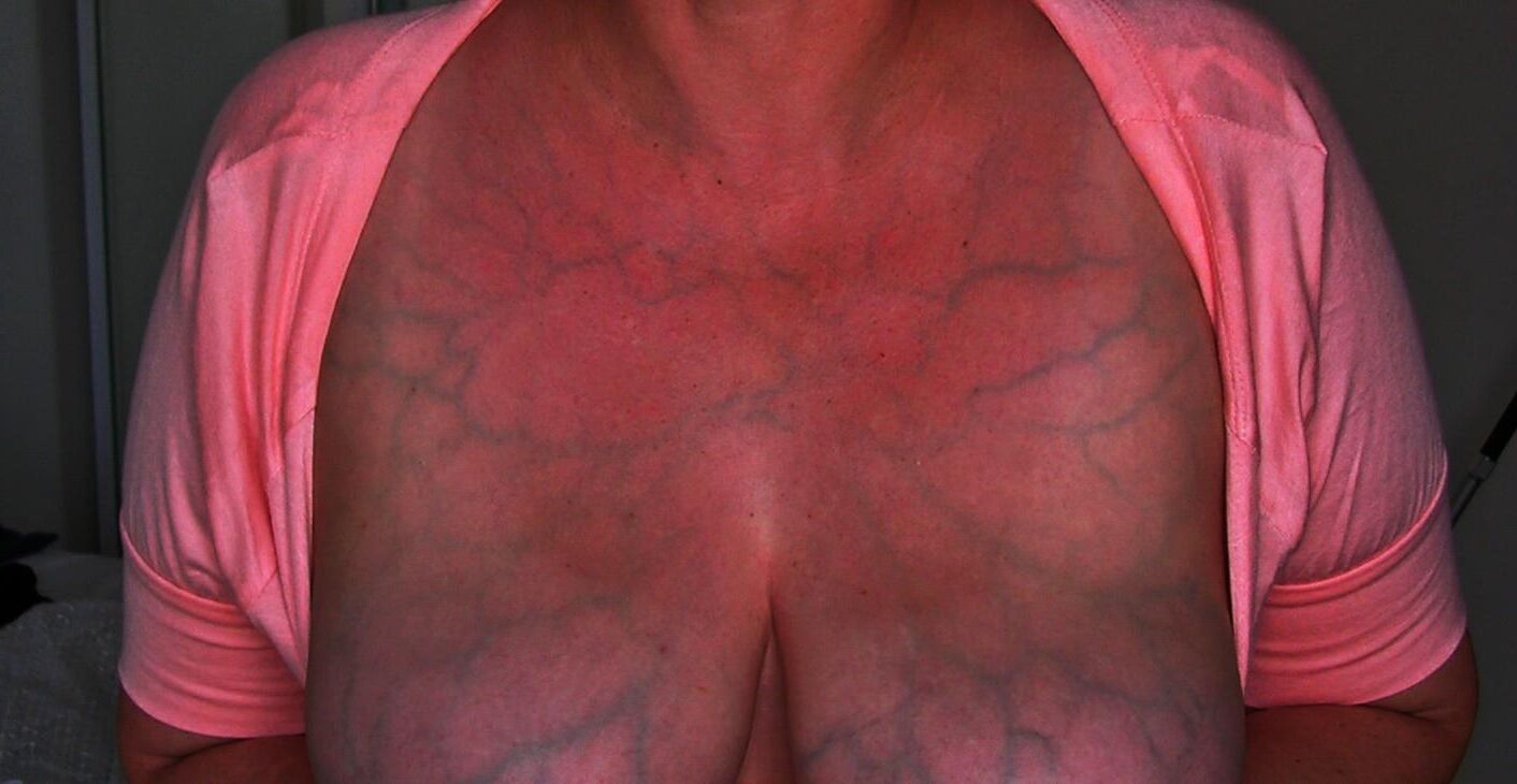 More Veins Homegrown