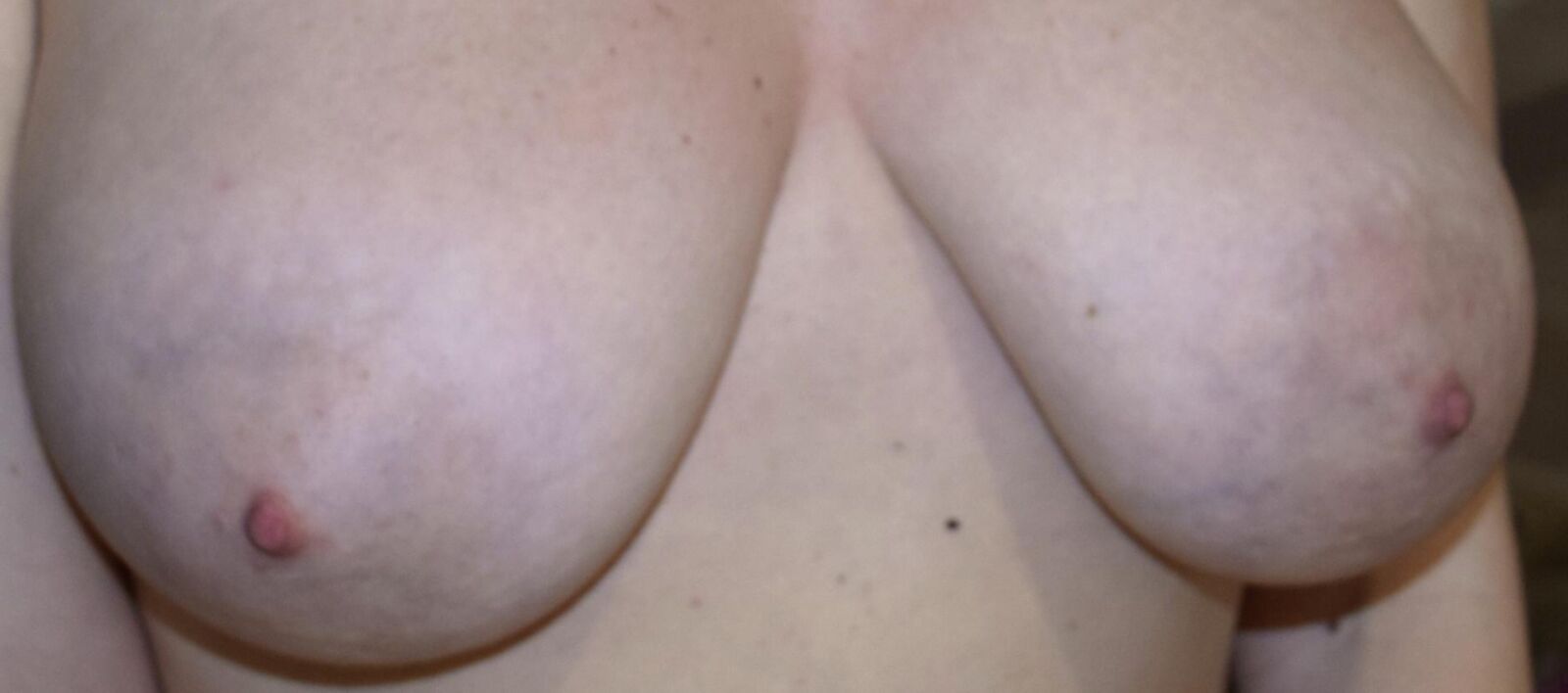 DES MAMELLES / DES MAMELLES ET DES MAMELLES