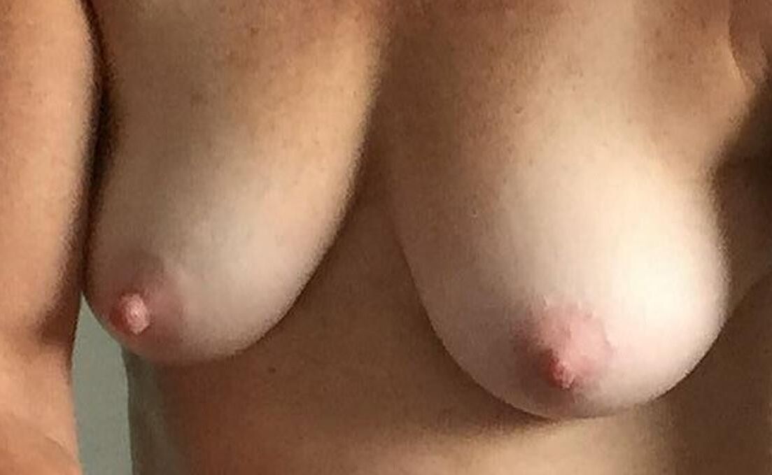 DES MAMELLES / DES MAMELLES ET DES MAMELLES