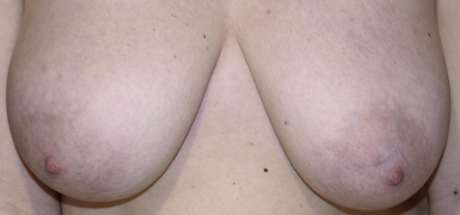 DES MAMELLES / DES MAMELLES ET DES MAMELLES