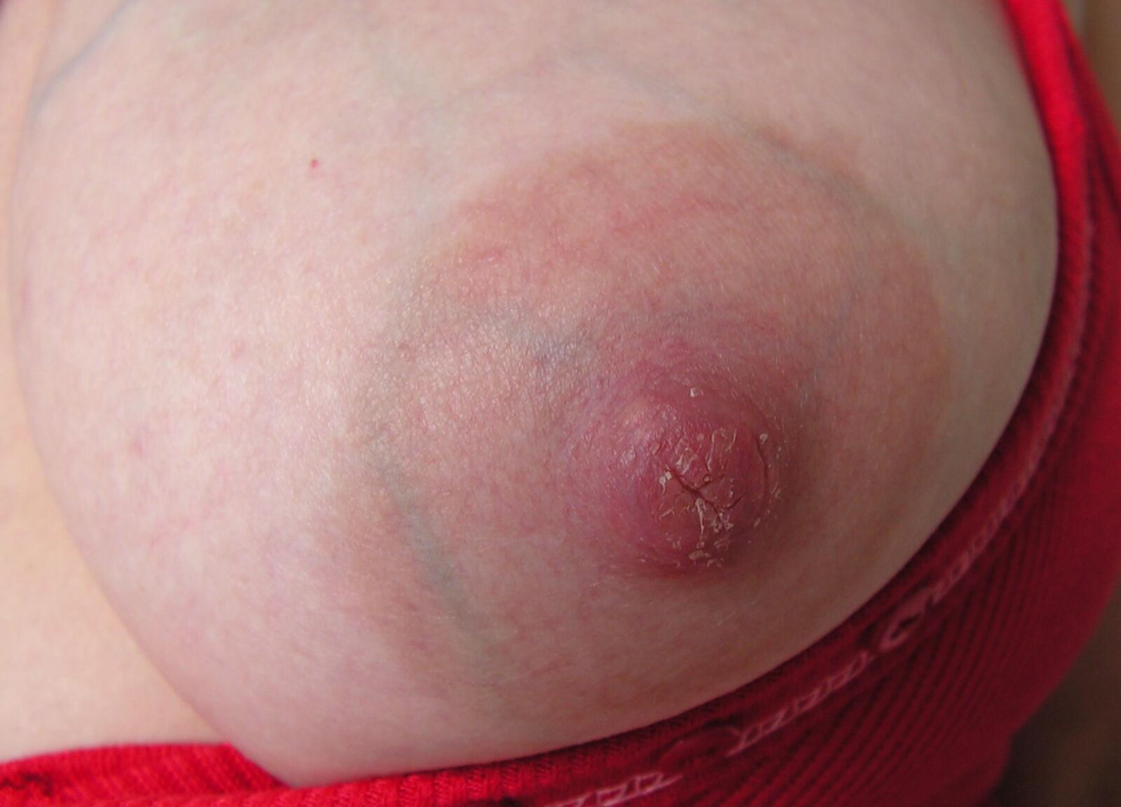 Tit Series, Homegrown