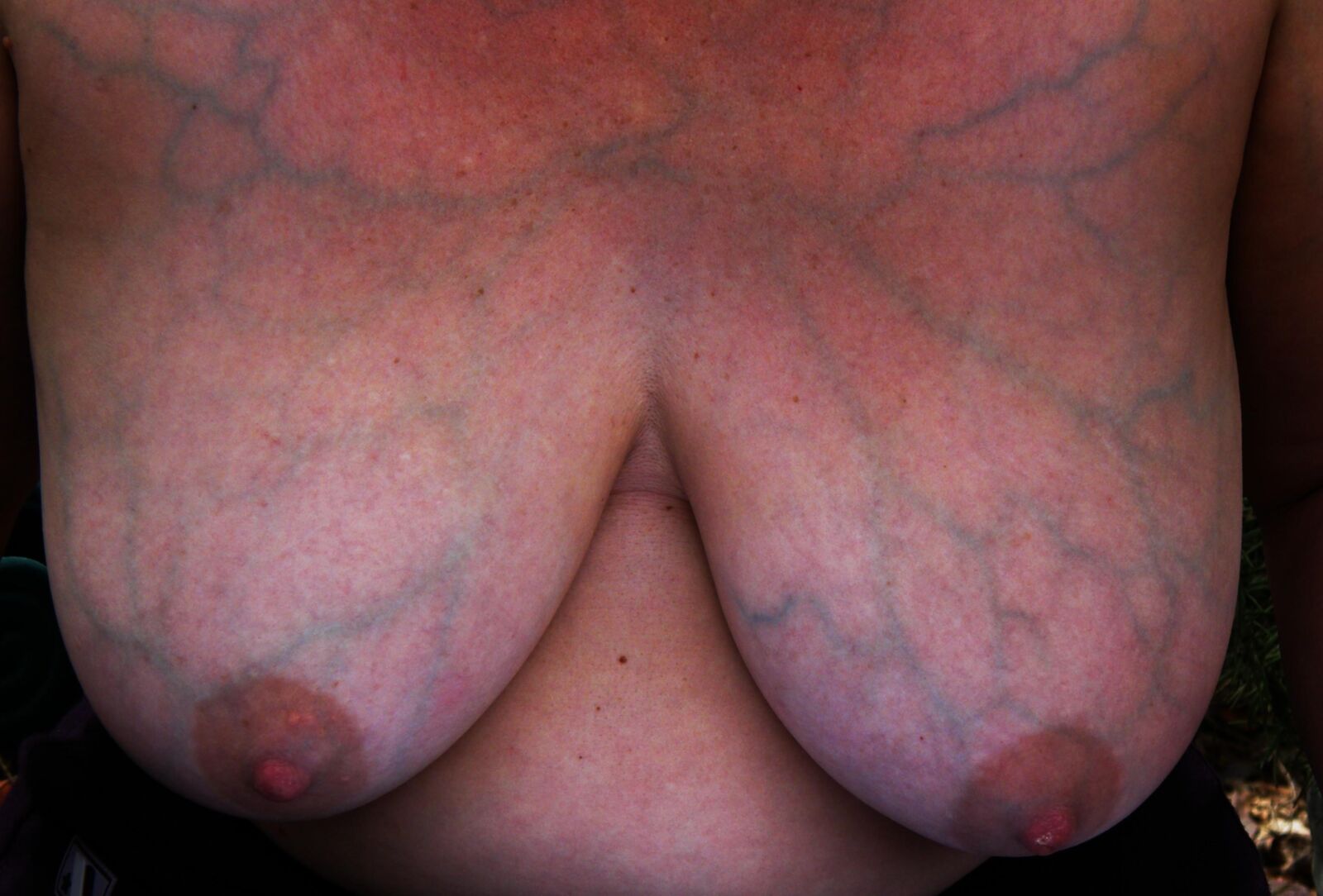 Nipplles and the Veins that Feed them and Run Through them 