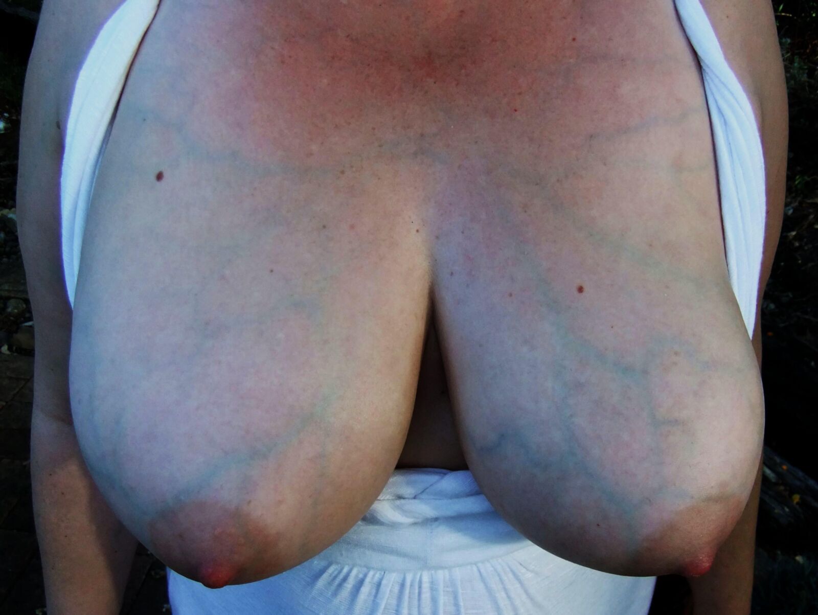 Nipplles and the Veins that Feed them and Run Through them 