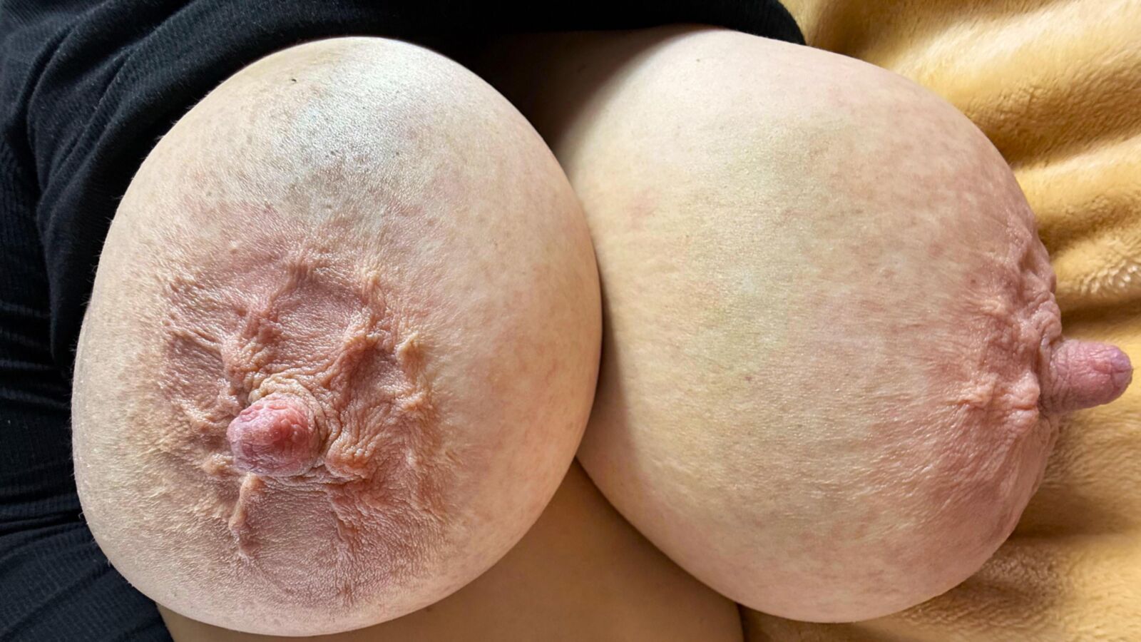 Only Tits#
